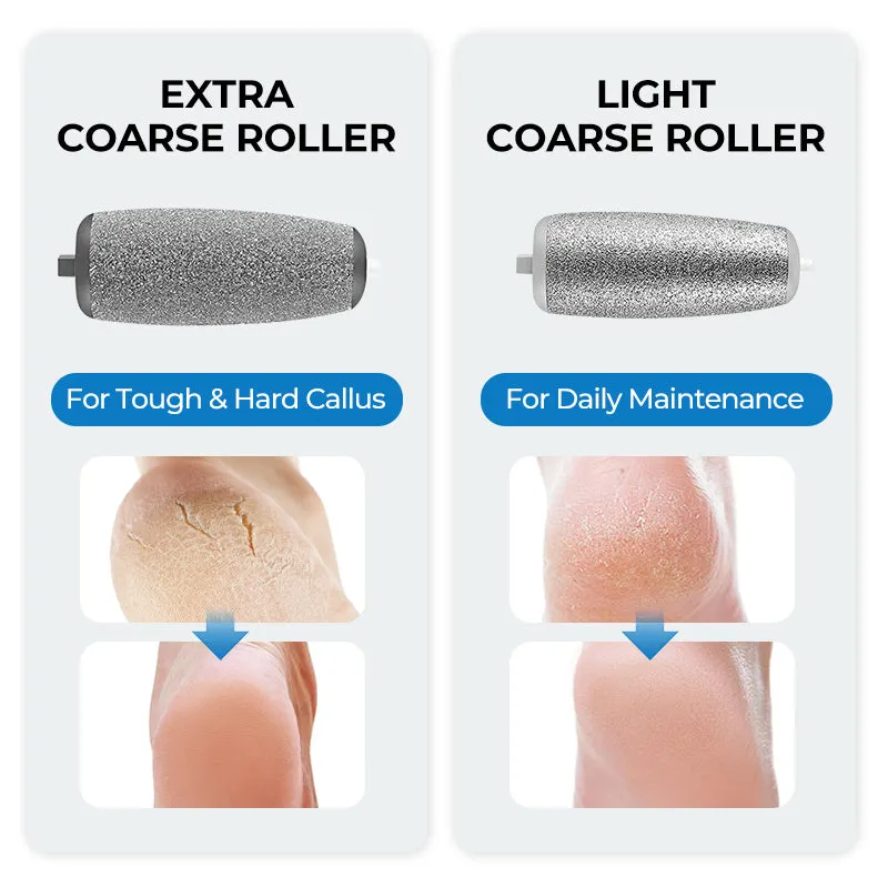 Hot Sale - 50% OFFElectric Feet Callus Remover